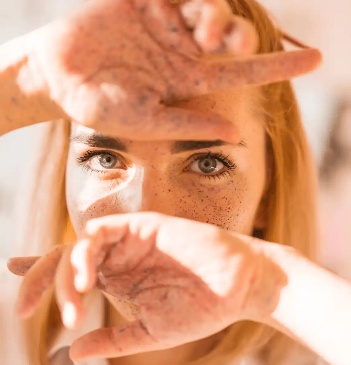 tratamiento para la rosacea